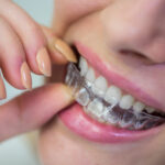 Invisalign Westlake Village CA